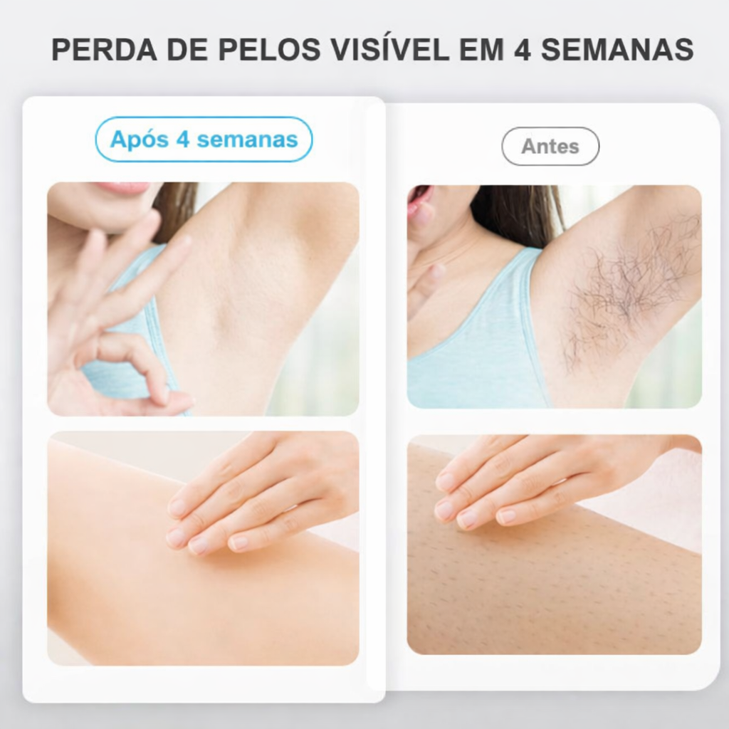 LumiSkin IPL - Diga adeus aos pelos indesejados. Assuma o controle