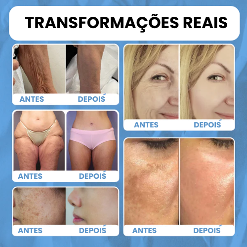 DermaBee Pro™ - Alívio total da dor e rejuvenescimento da pele no mesmo dia