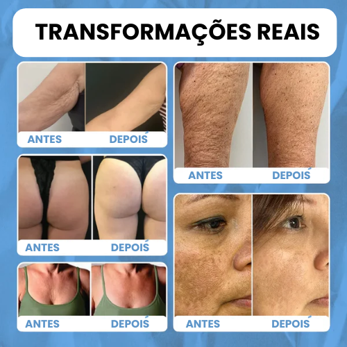 DermaBee Pro™ - Alívio total da dor e rejuvenescimento da pele no mesmo dia
