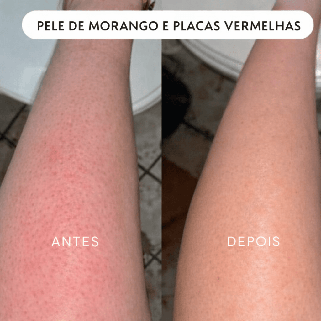 Depiladora Íntima 2 em 1 — Suave & Precisa