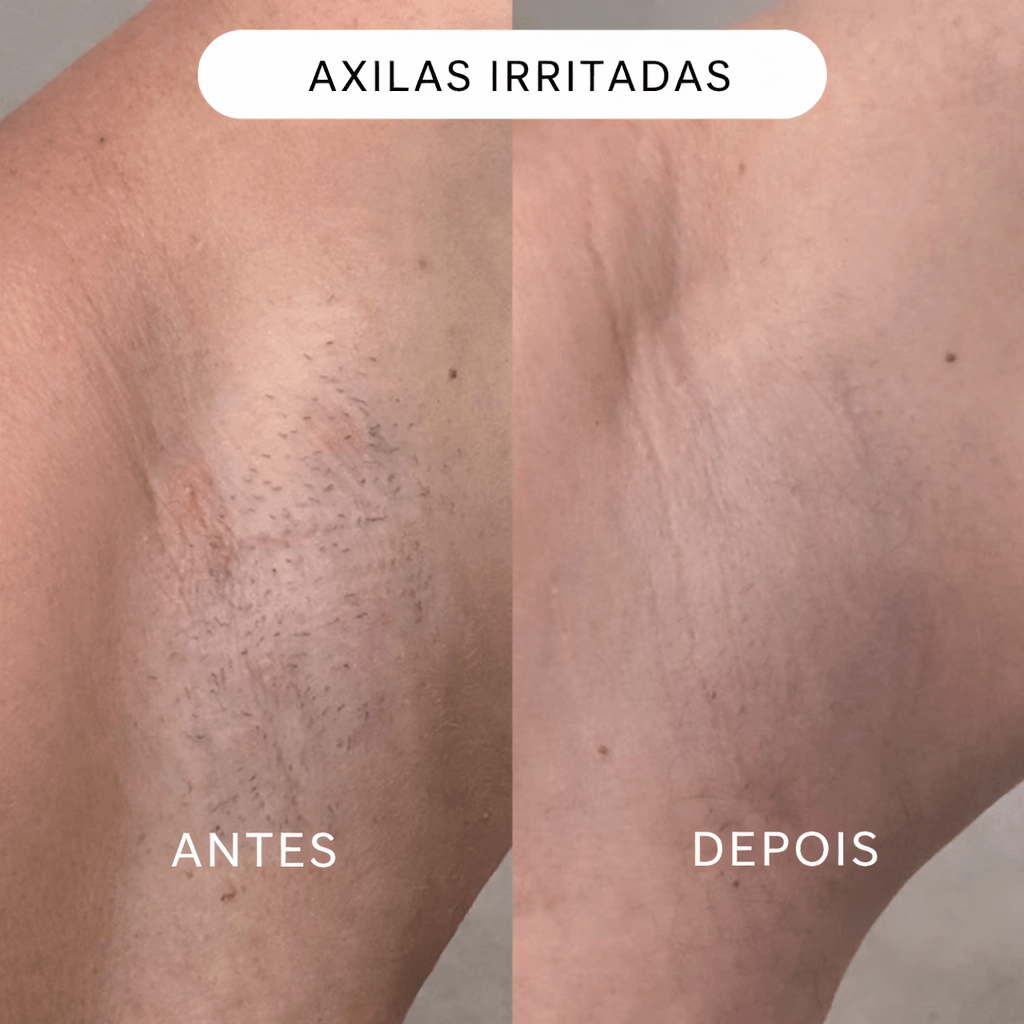 Depiladora Íntima 2 em 1 — Suave & Precisa
